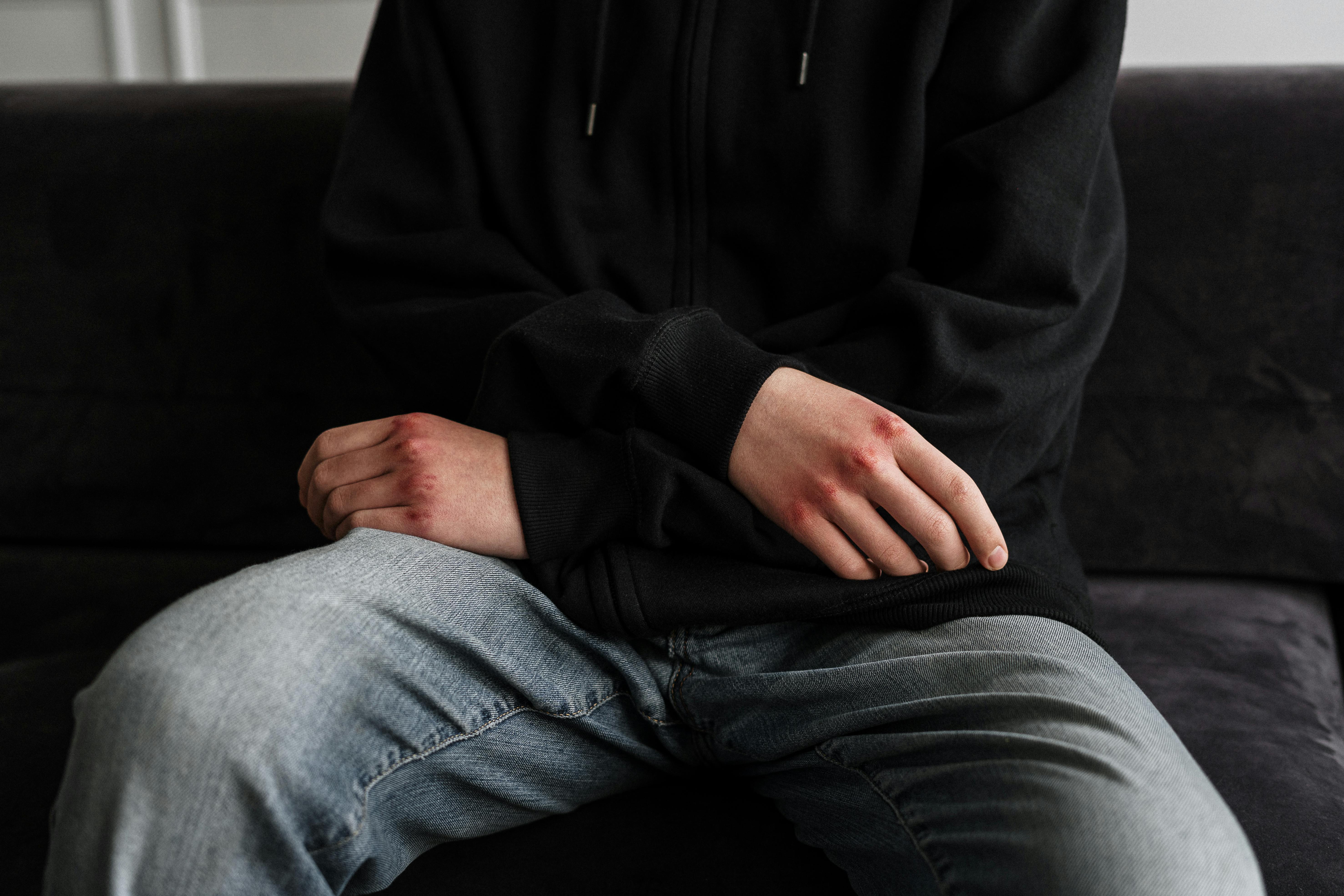 Breaking the Cycle of Self Harm Relapse